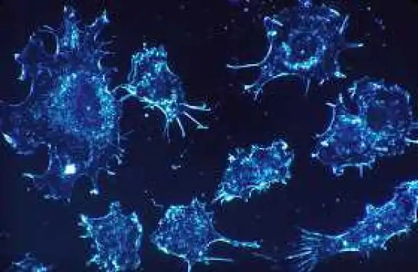 Bad luck causes most Cancer, new study finds